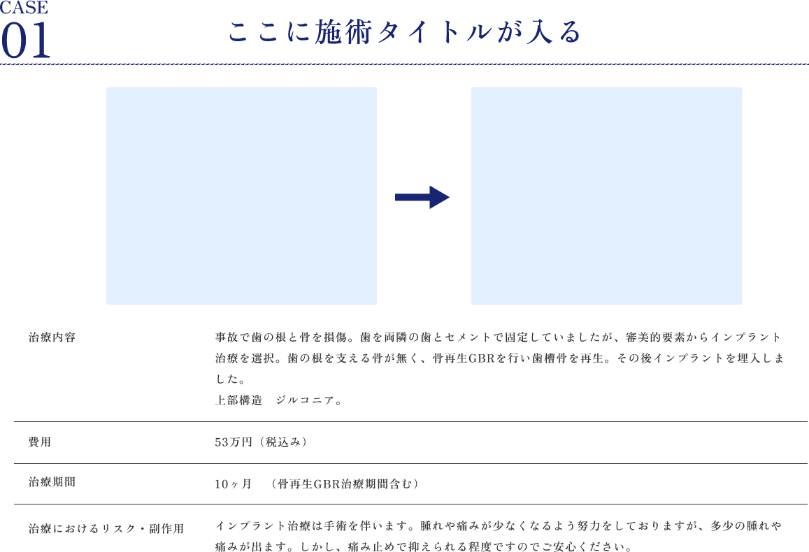 準備中